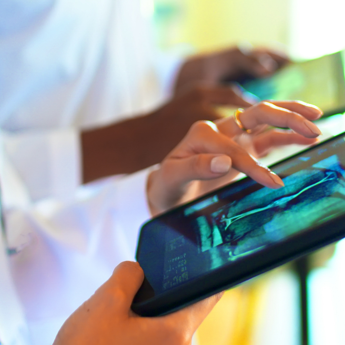 Doctor's in a row working looking at CT Scan with digital tablets.