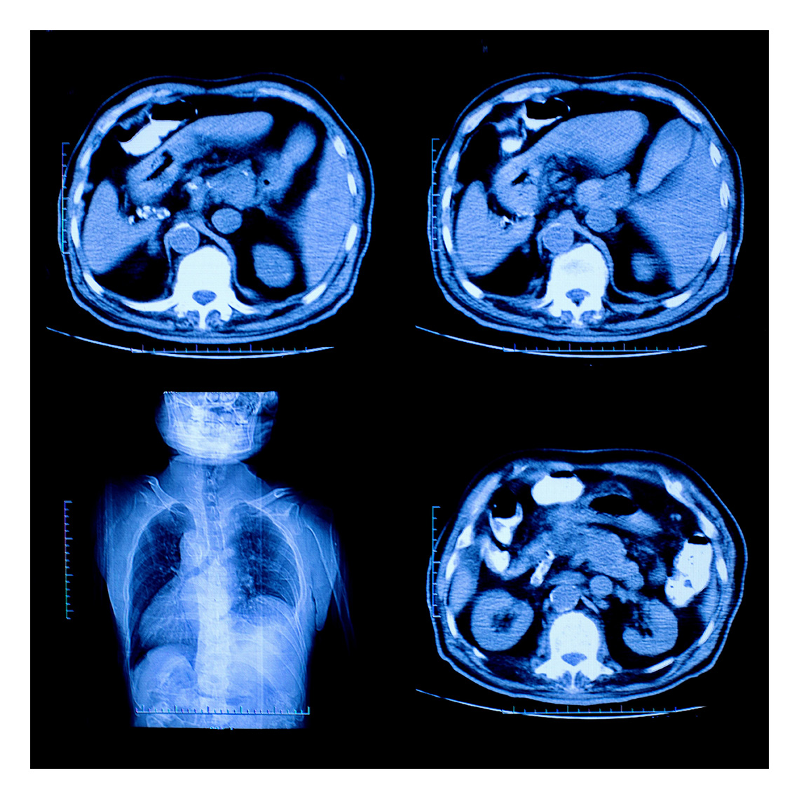 a ct scan